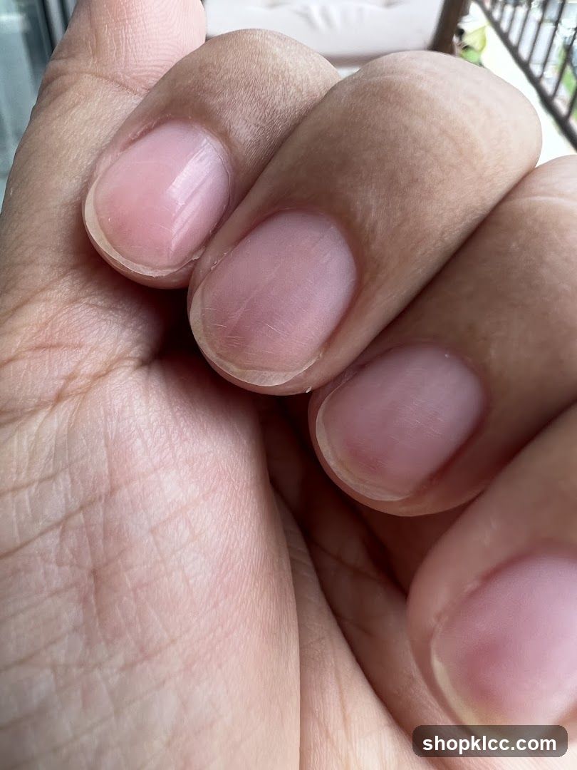 Close-up of fingernails