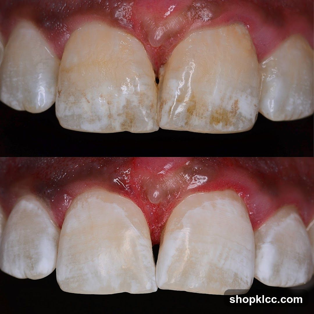 Before and After Dental Treatment
