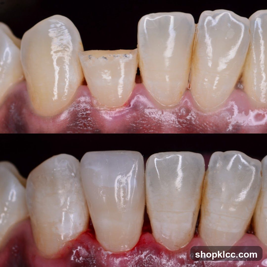 Dental Restoration Comparison