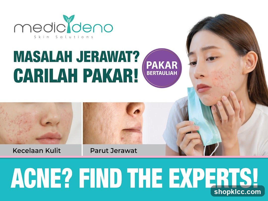 Acne Solutions Advertisement