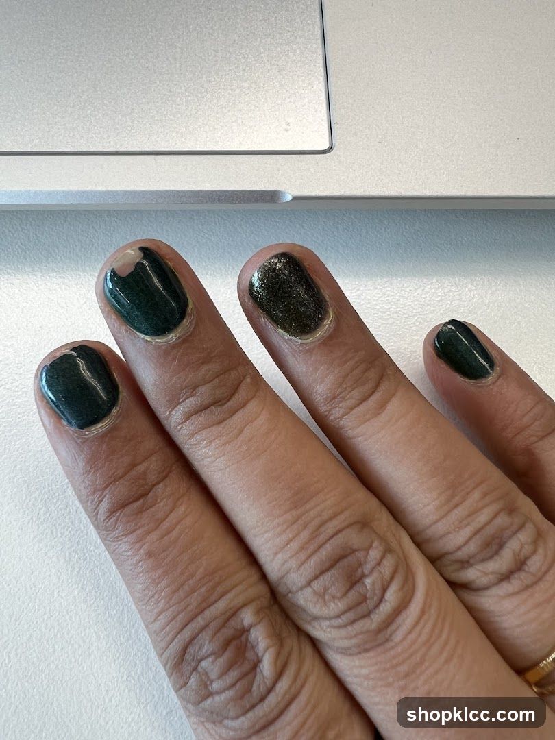 Fingers with chipped dark green nail polish