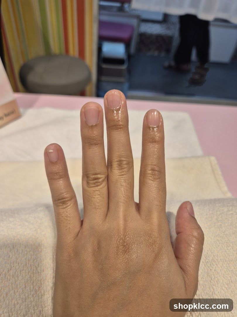 Nail Care