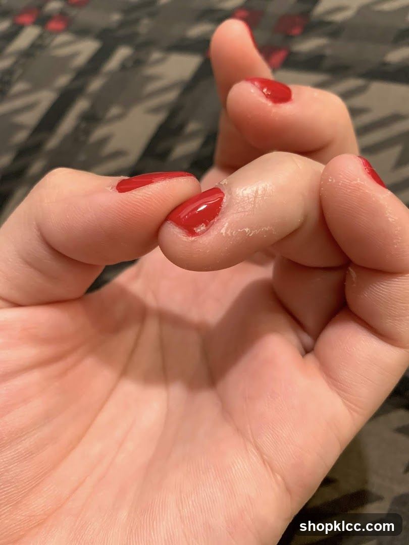 Hand with red nail polish showing skin condition