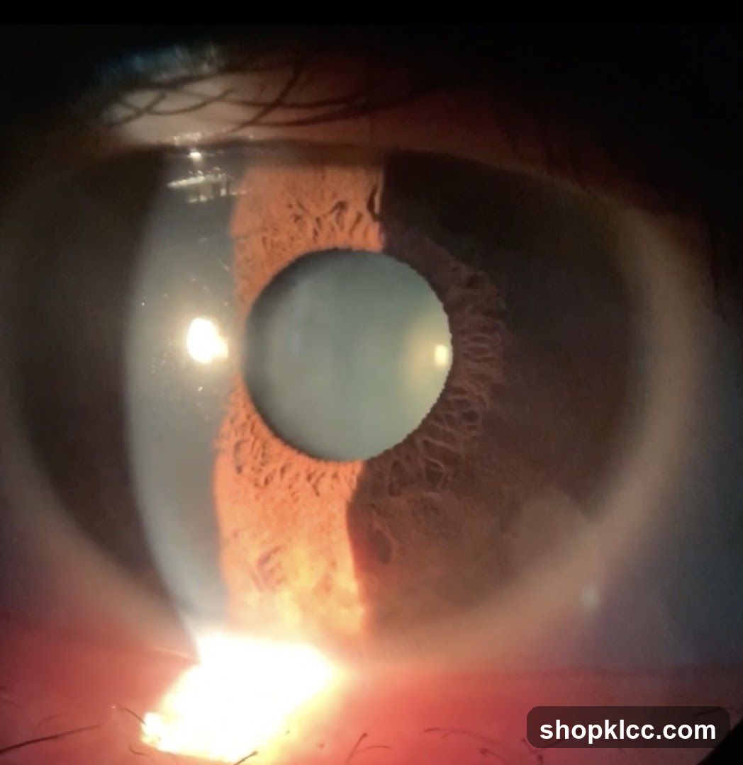Close-up of an eye
