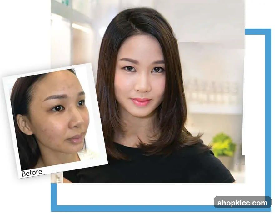 Before and After Skin Treatment