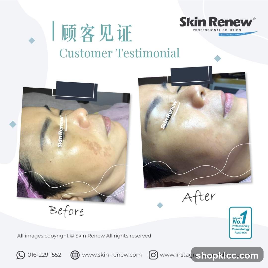 Skin Renew Customer Testimonial