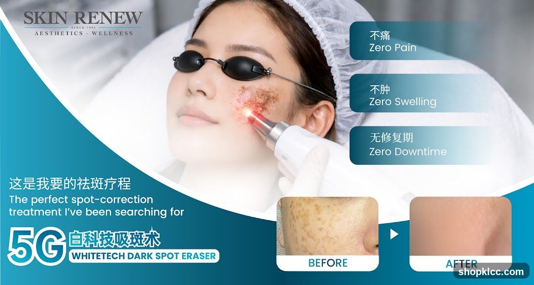Skin Renew Advertisement