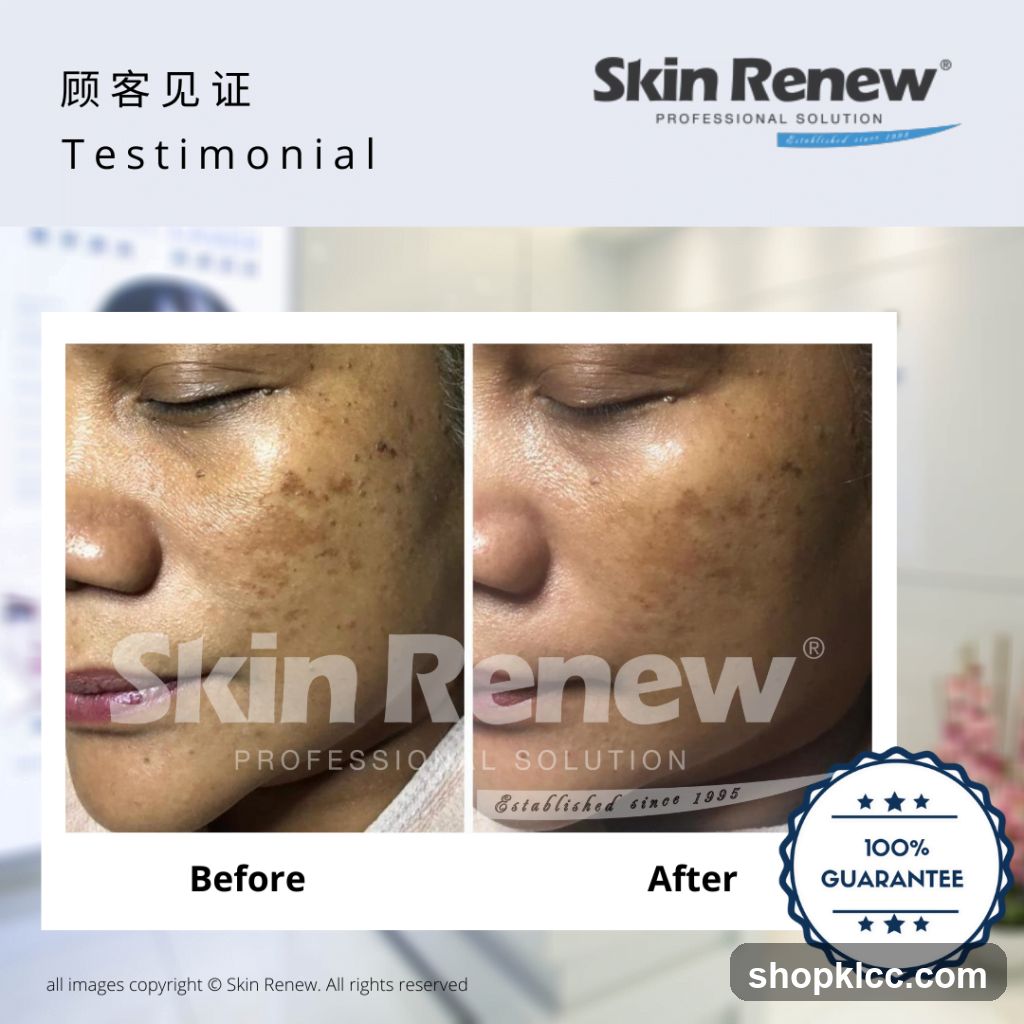 Skin Renew Testimonial