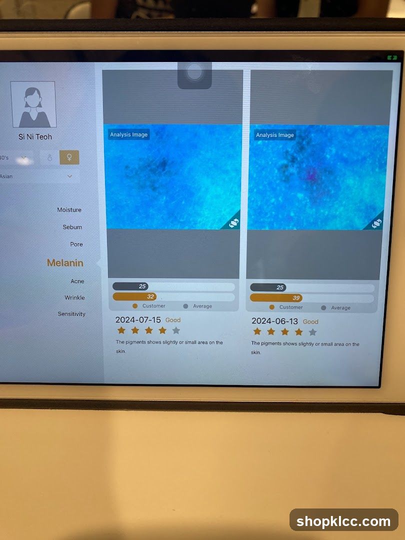 Skin Analysis App Interface