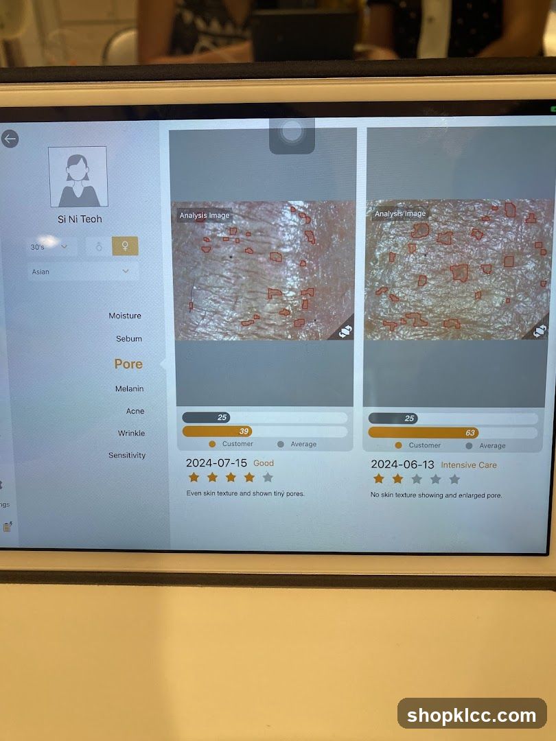 Skin Analysis Device Screen