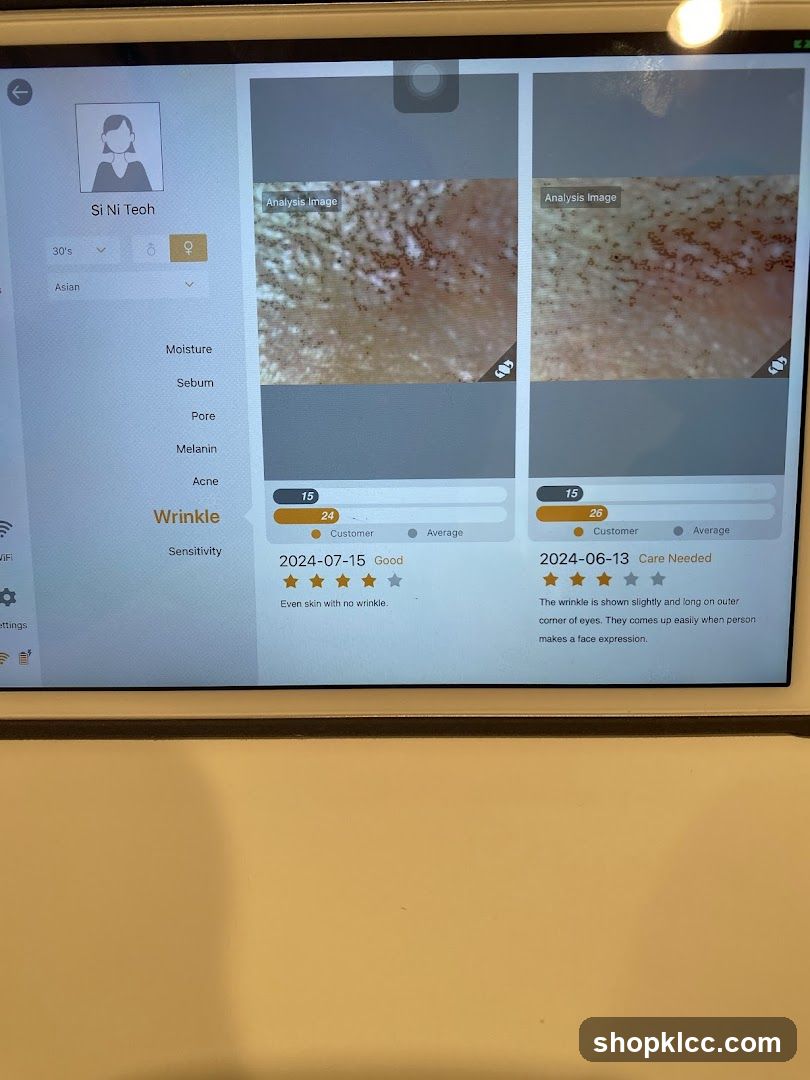 Skin Analysis App Interface
