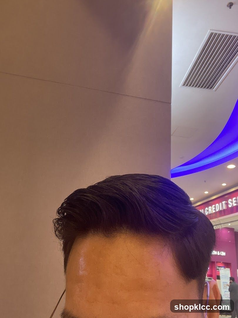 Man's Forehead and Hair