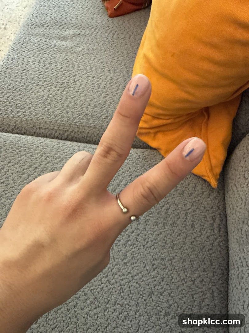 Hand with two fingers up and blue marks on nails