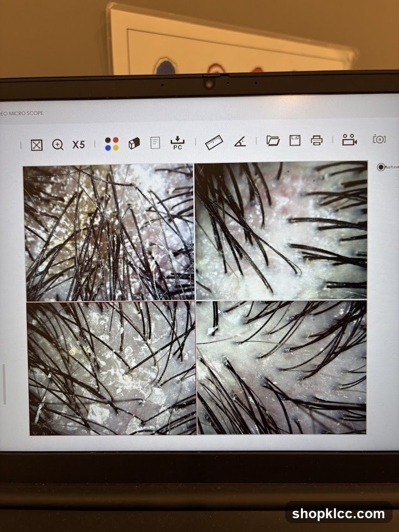 Microscope Images of Hair Follicles