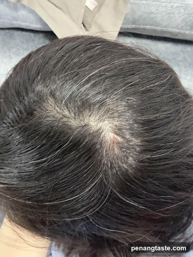 Close-up of a person's scalp with dark hair and visible gray strands.