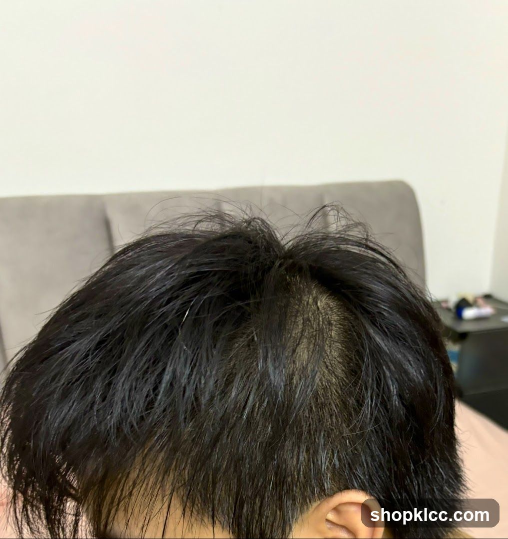 Hairline