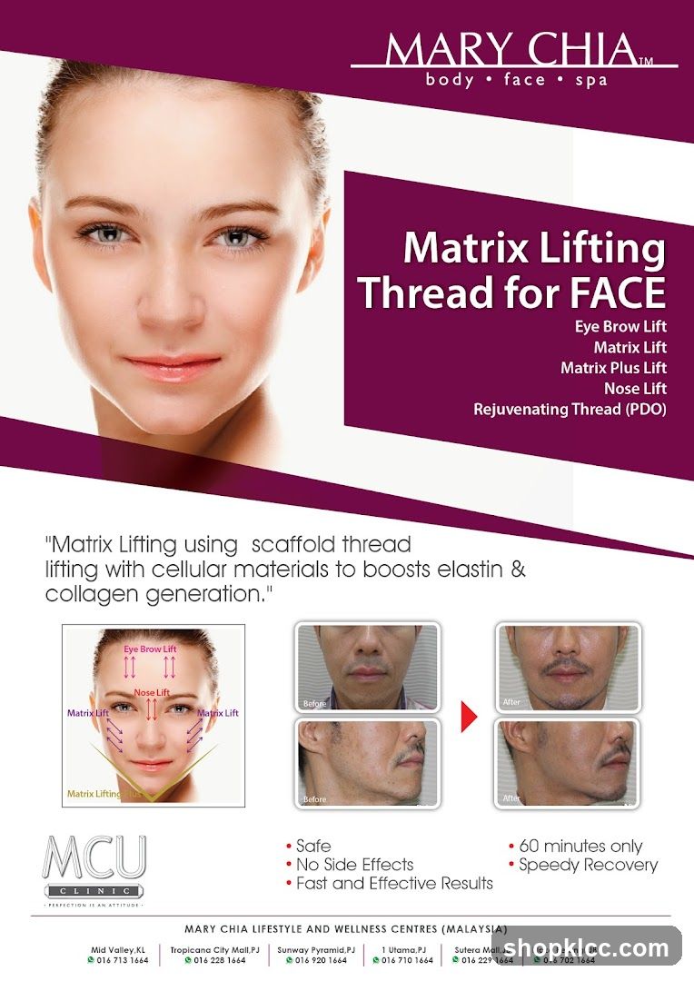 Mary Chia Matrix Lifting Thread for Face