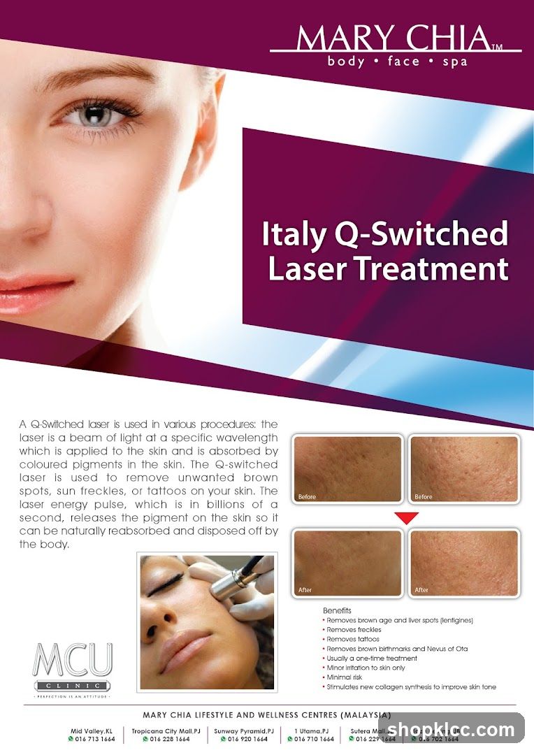 Mary Chia Laser Treatment Advertisement