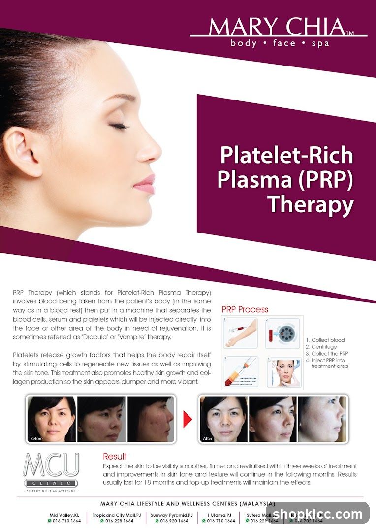 Platelet-Rich Plasma (PRP) Therapy