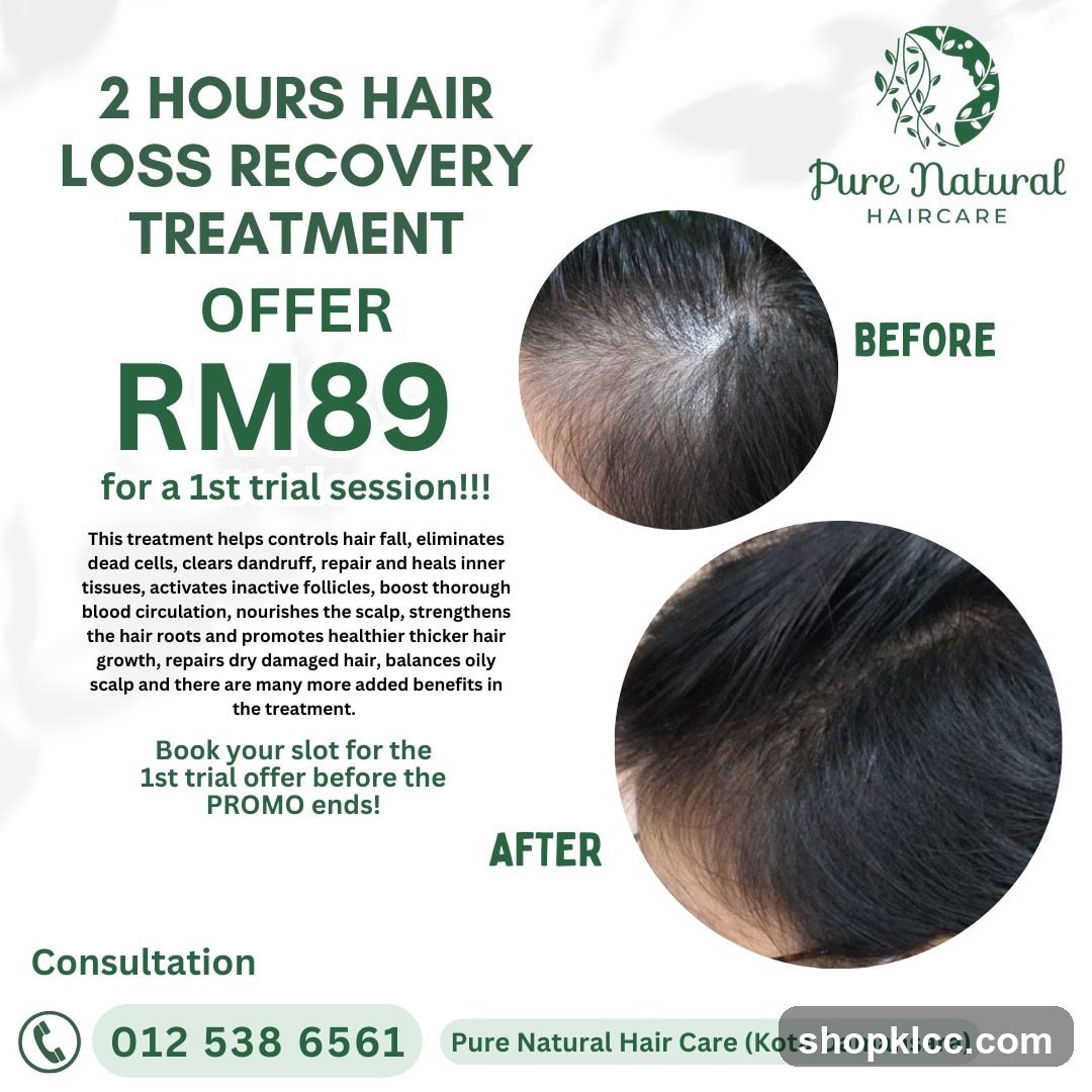 Hair Loss Recovery Treatment Offer