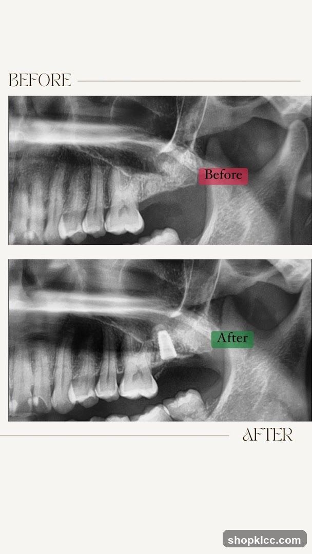 Dental X-ray Before and After