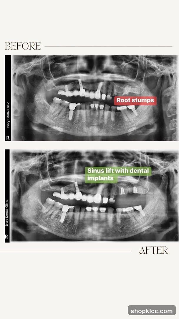 Dental X-ray Before and After