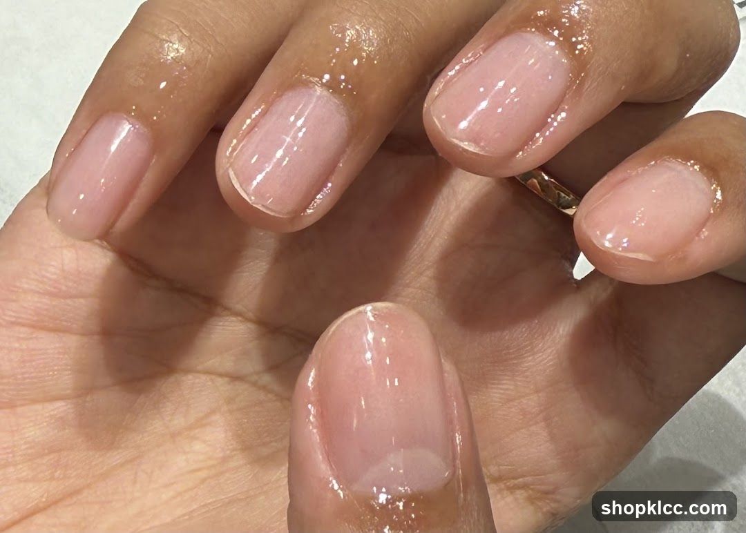 I-Nail