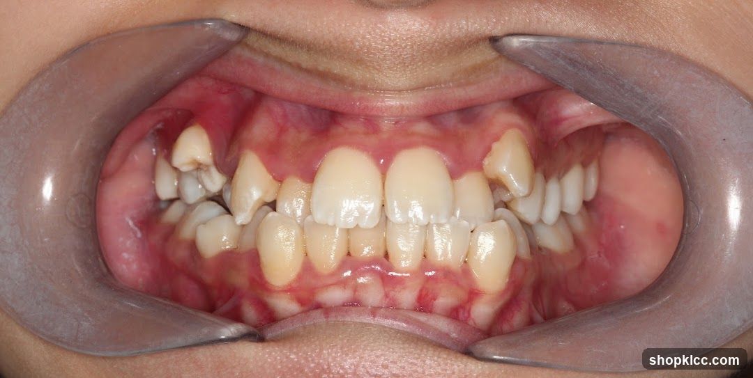 Dental Examination