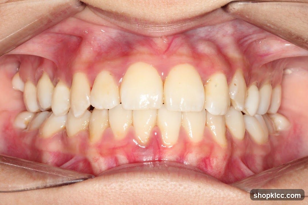 Dental Examination