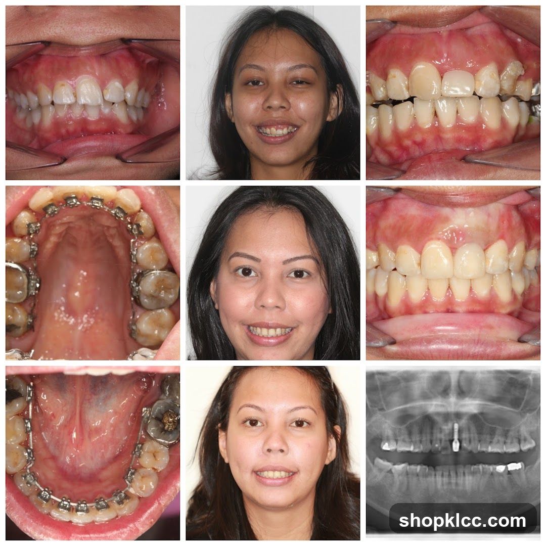 Dental Progress Photos
