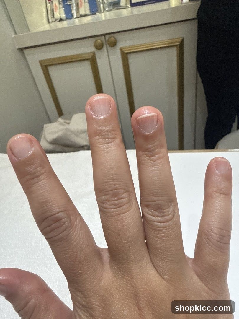 Hand with unpolished nails