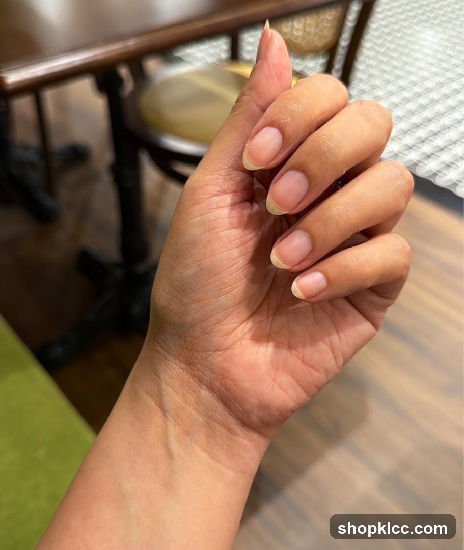 Hand with unpolished nails