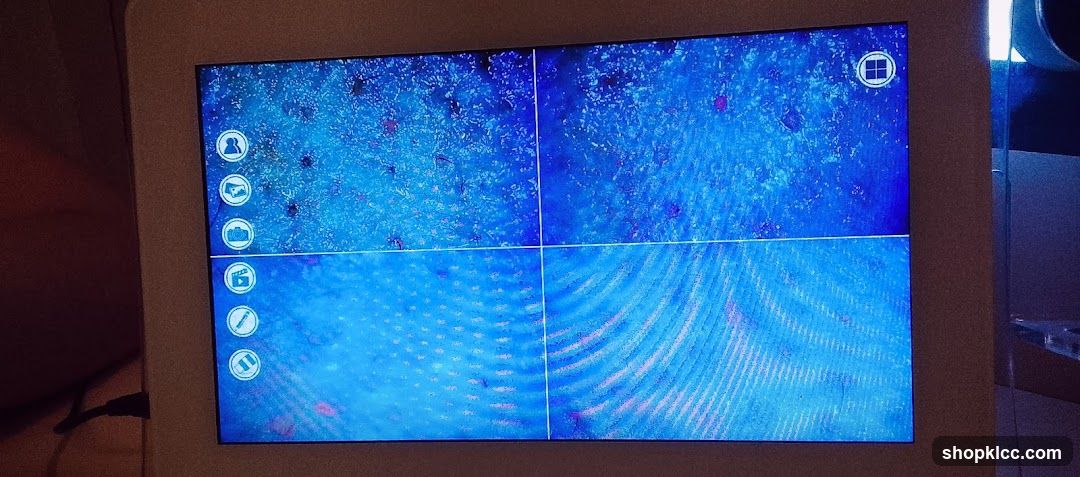 Microscope Screen Display