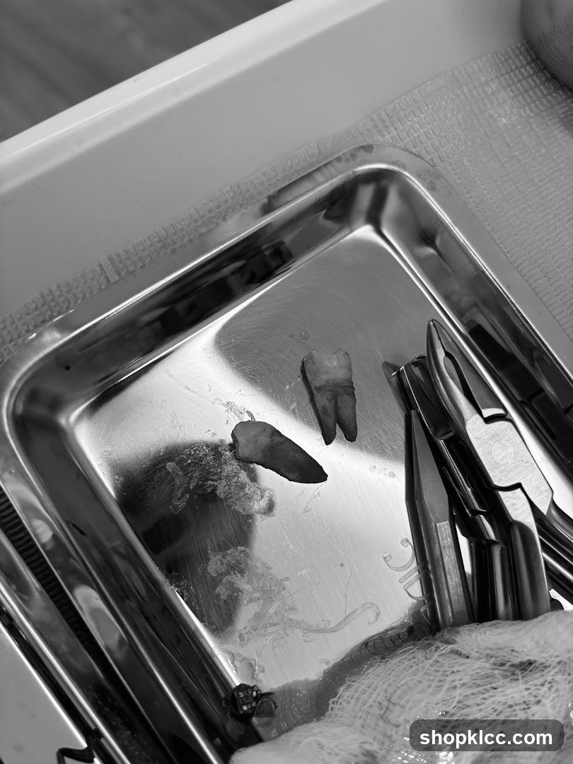 Dental Extraction Tray