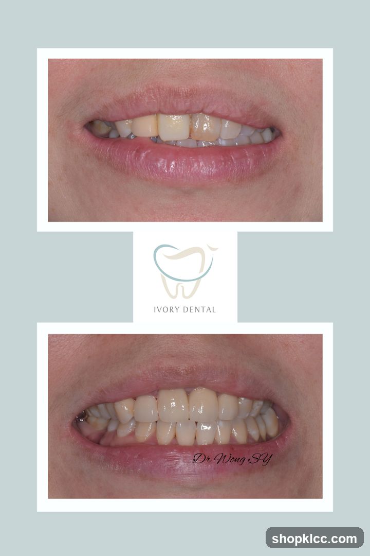 Dental Before and After