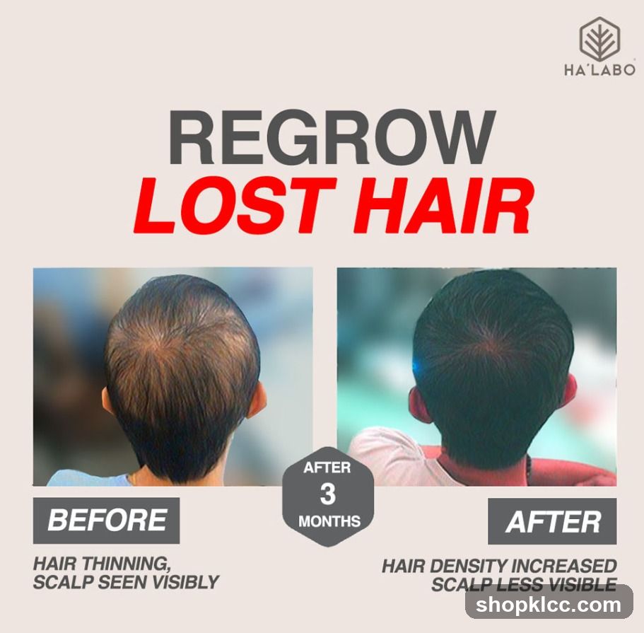 Regrow Lost Hair Ad