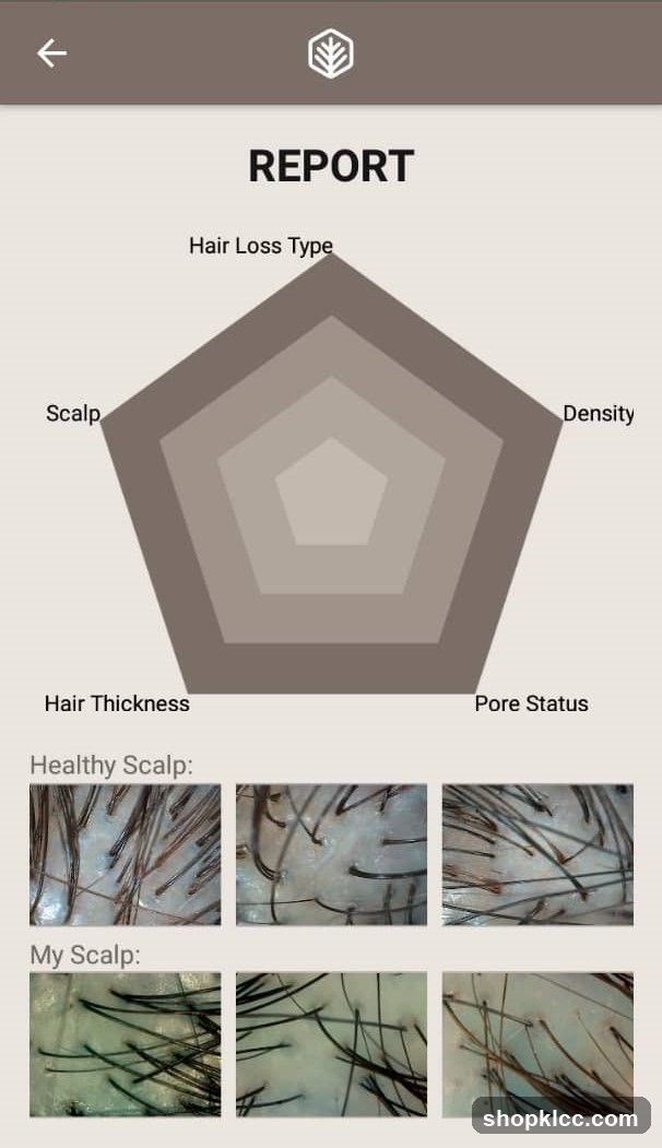 Hair Health Report