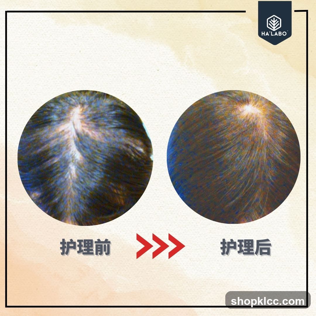 Hair Care Before and After Comparison