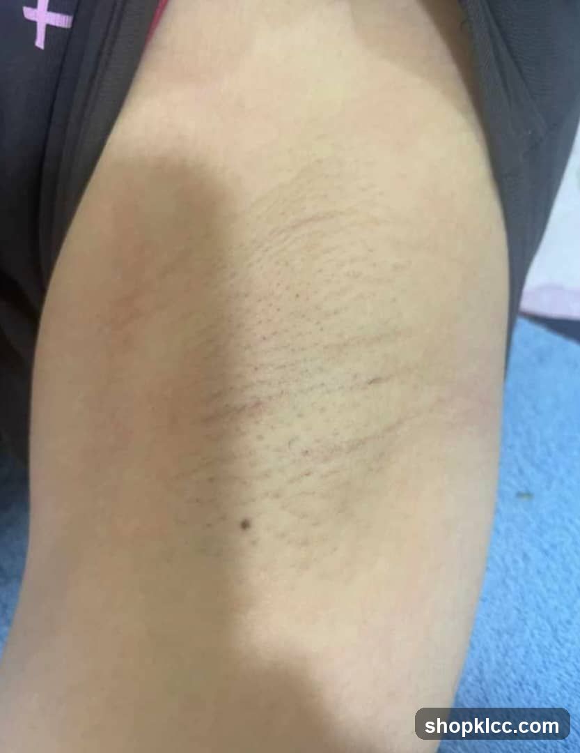 Skin with visible hair follicles and minor marks