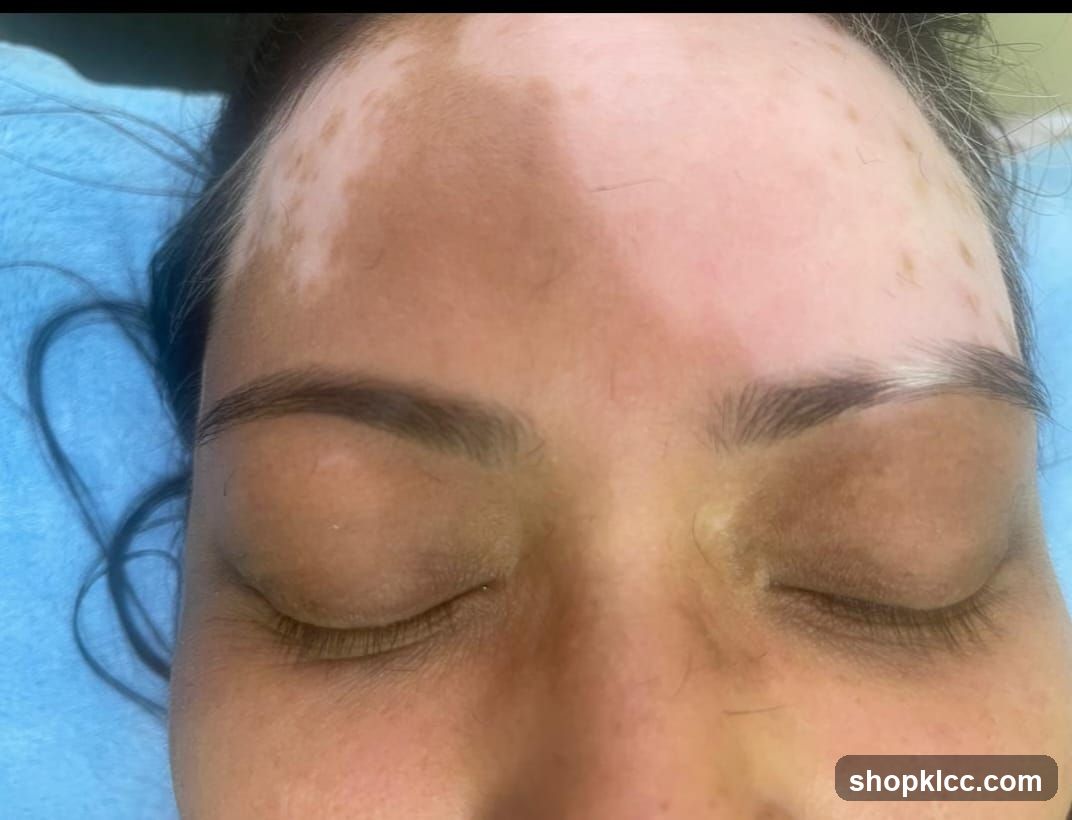 Face with skin condition