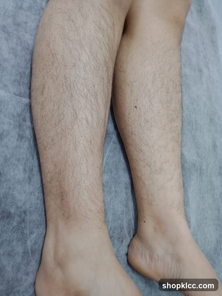 Legs on Examination Table