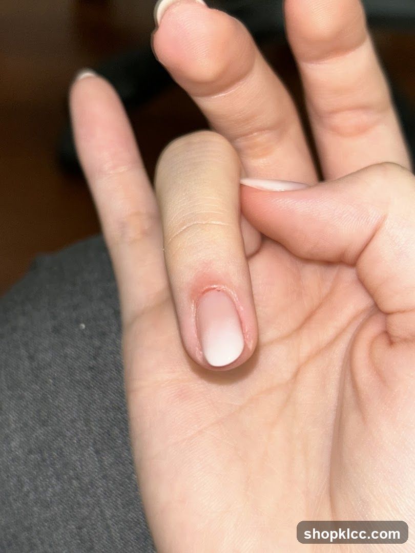 Hand with swollen finger