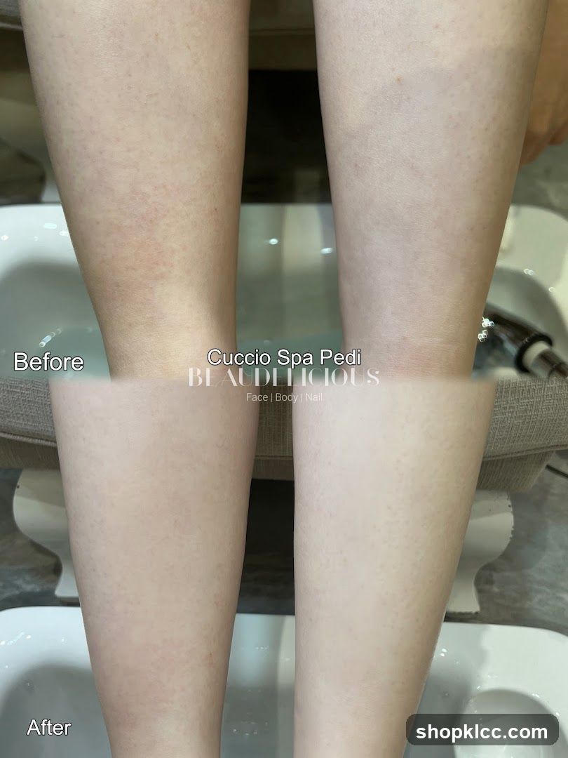 Before and After Pedicure