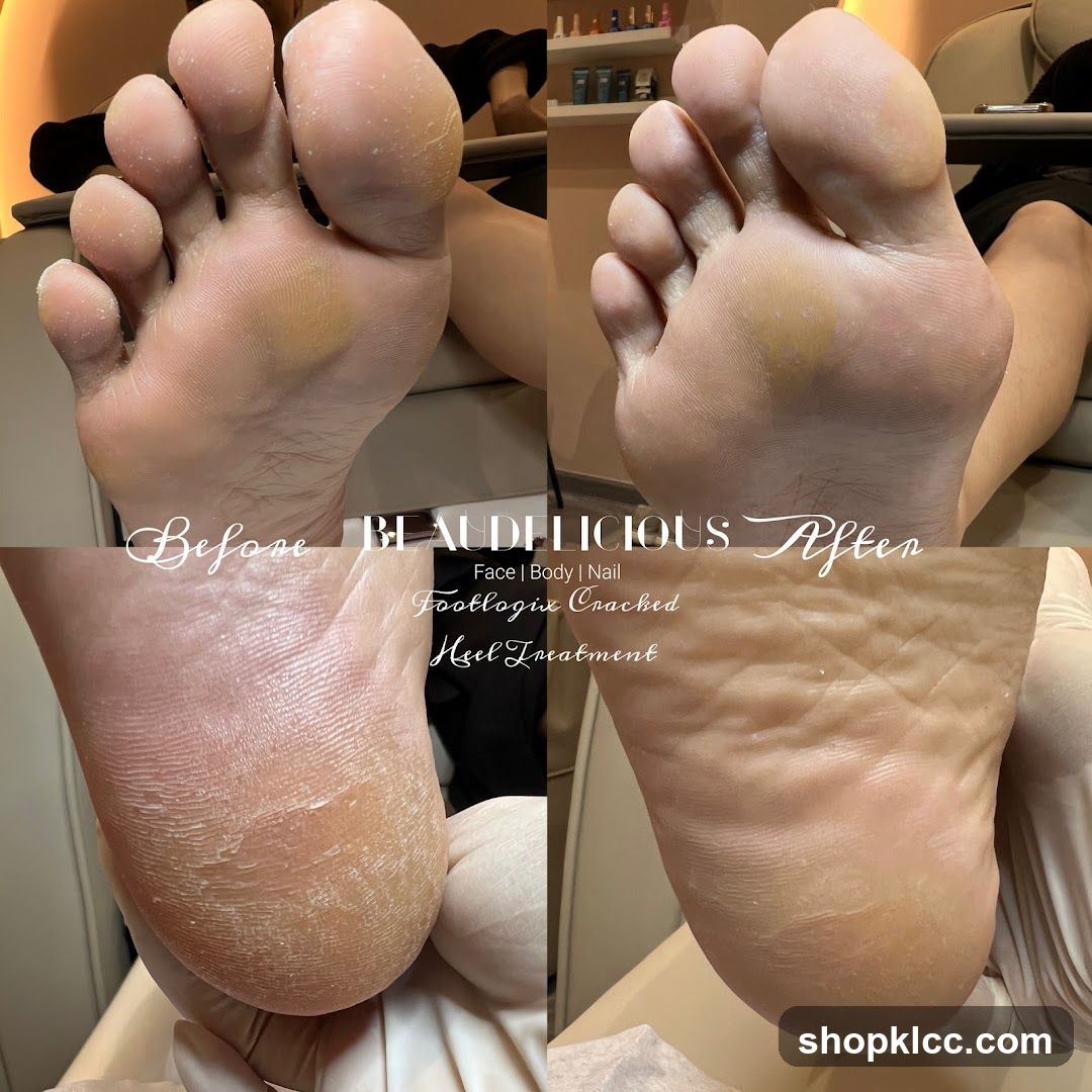 Before and After Foot Treatment
