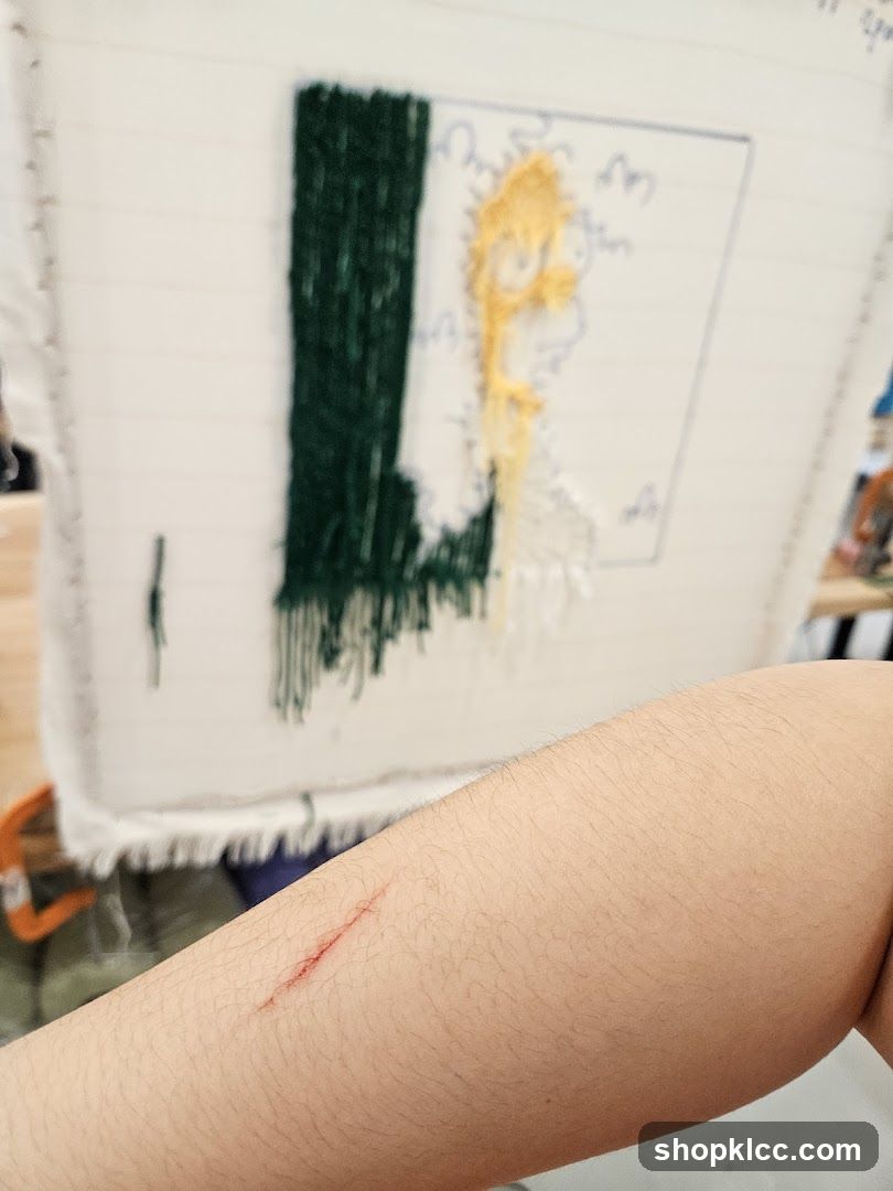 Scratched arm with embroidery in background