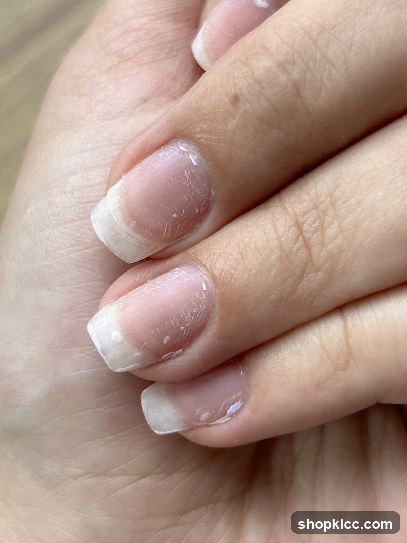 Nails with chipped polish