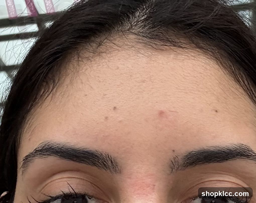 Forehead and Eyebrows