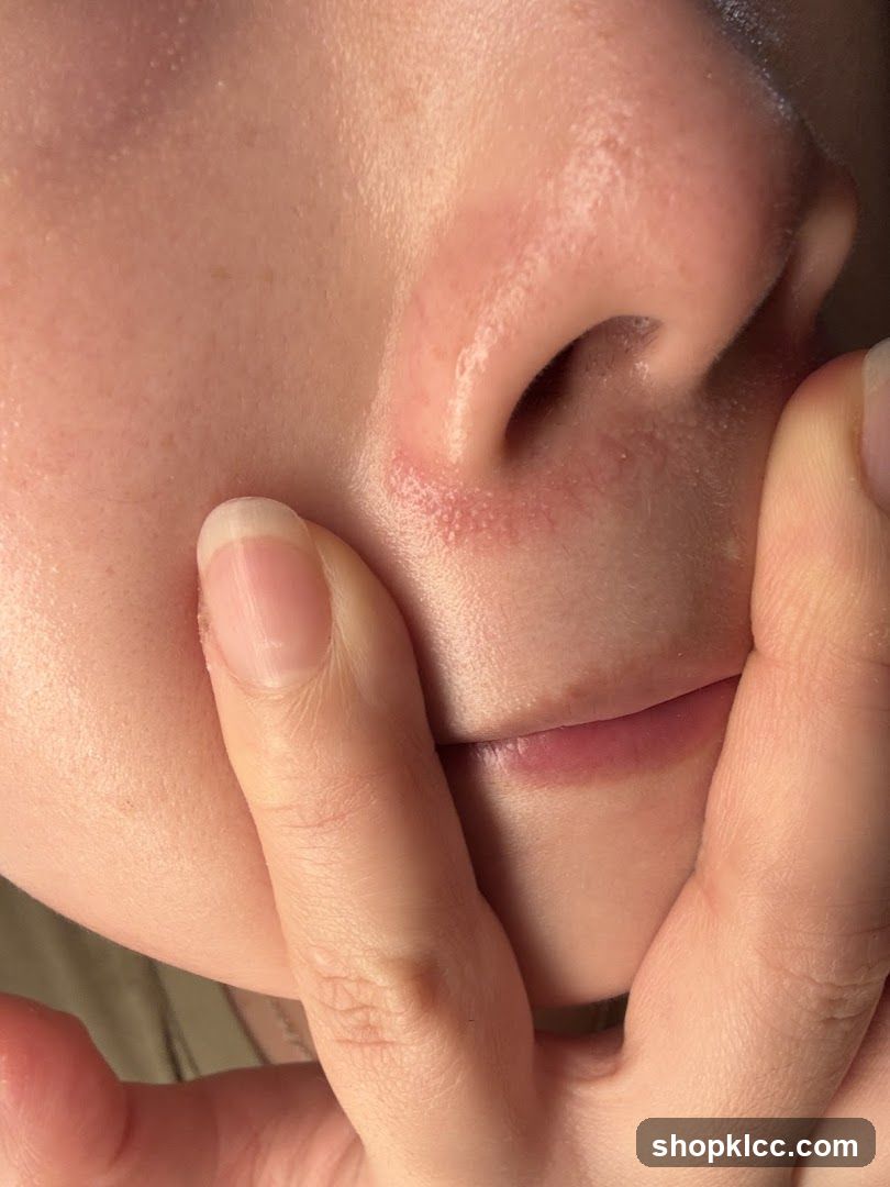Close-up of a person's nose and mouth area
