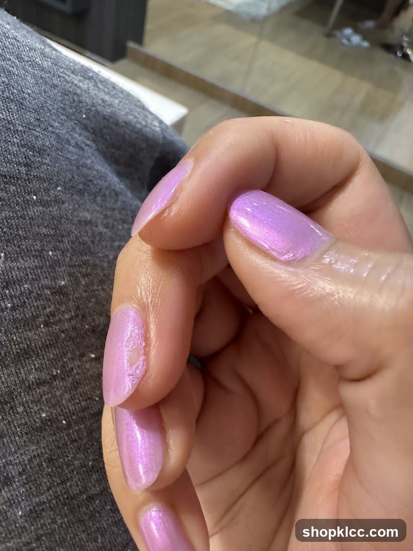 Close-up of a hand with chipped pink nail polish