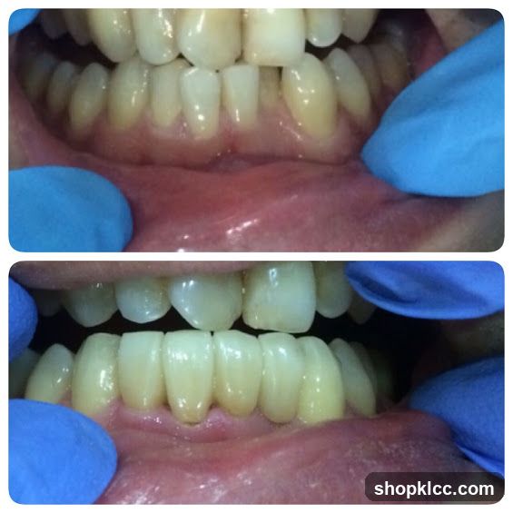Dental Examination